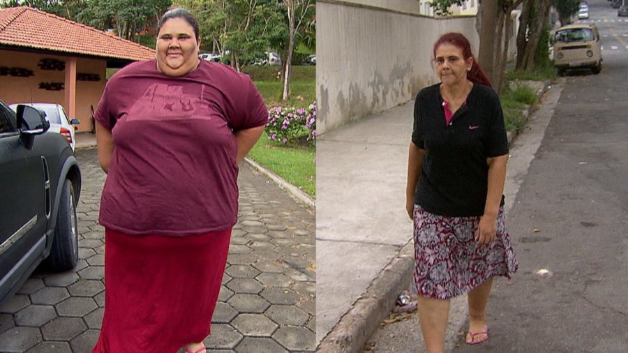 Câmera Record revela drama de mulher que perdeu 140 kg após cirurgia bariátrica