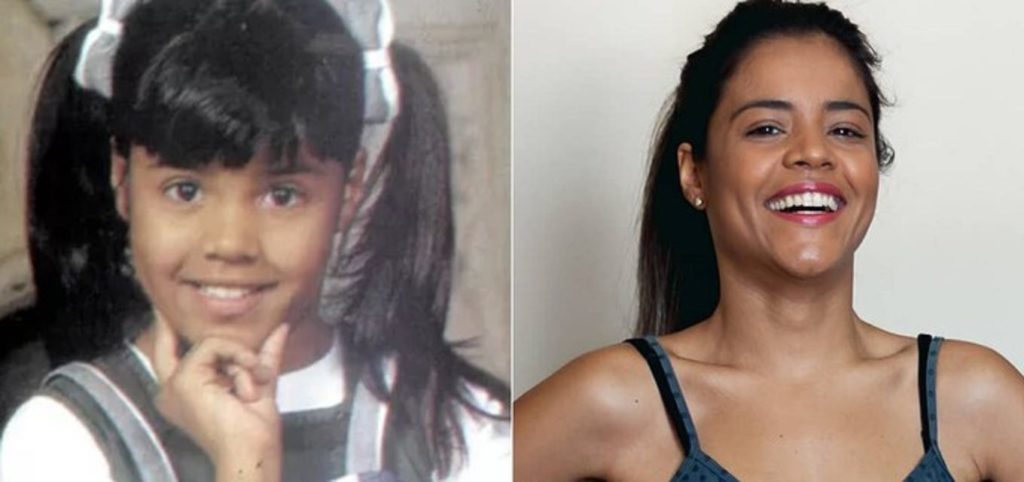 Giselle Medeiros antes e depois