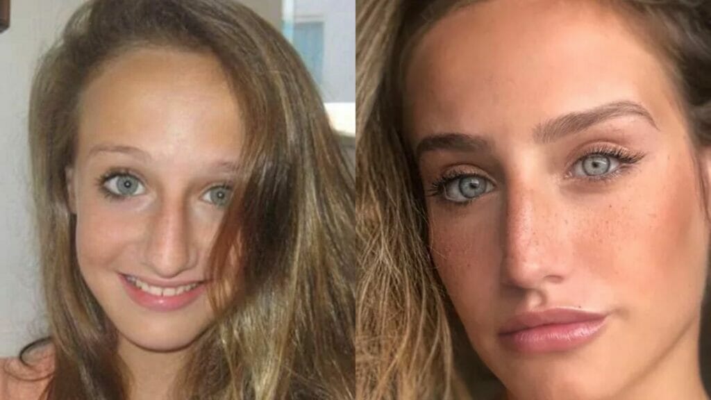 Antes e depois de Bruna Griphao